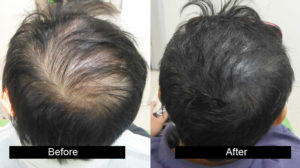 biostimulated-fue1.jpg  